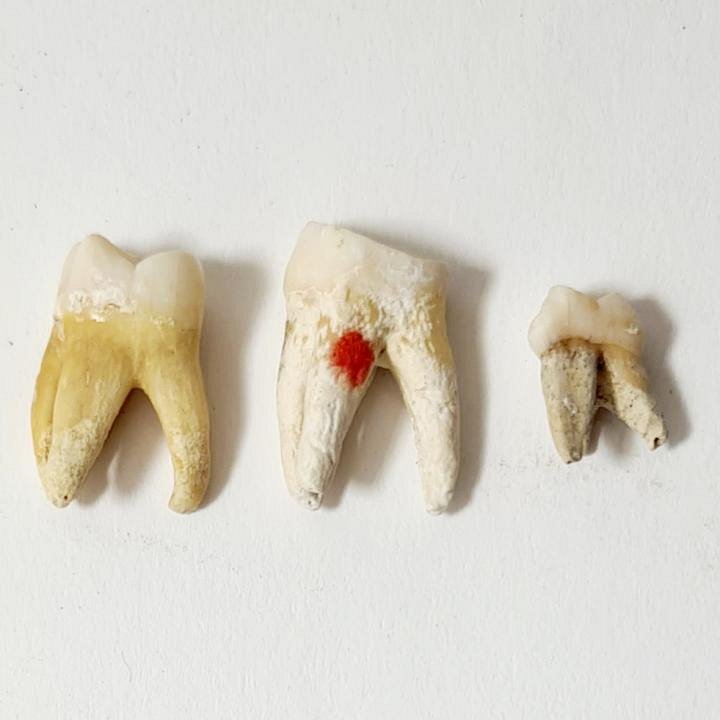 Molar Human Teeth