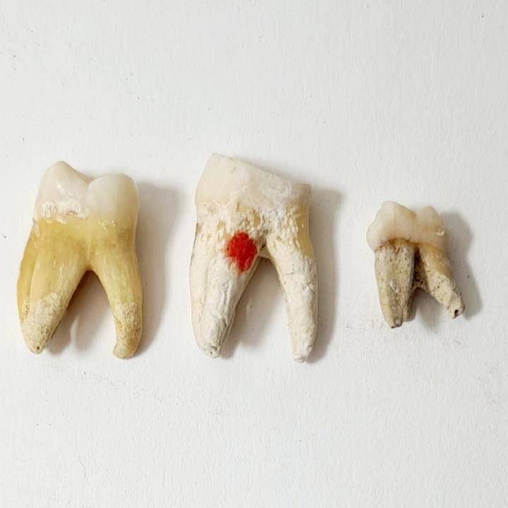 Molar Human Teeth