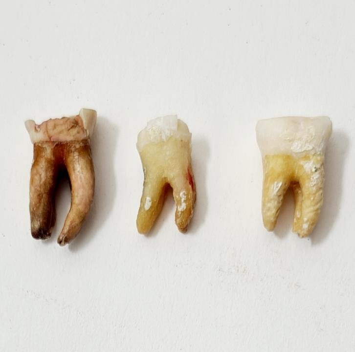 Premolar Human Teeth