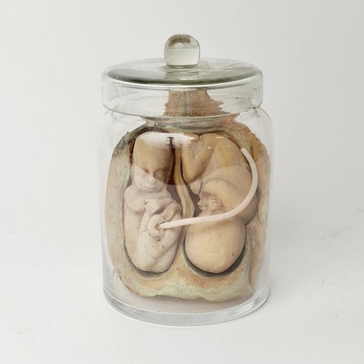 Foetus Model In Glass Jar