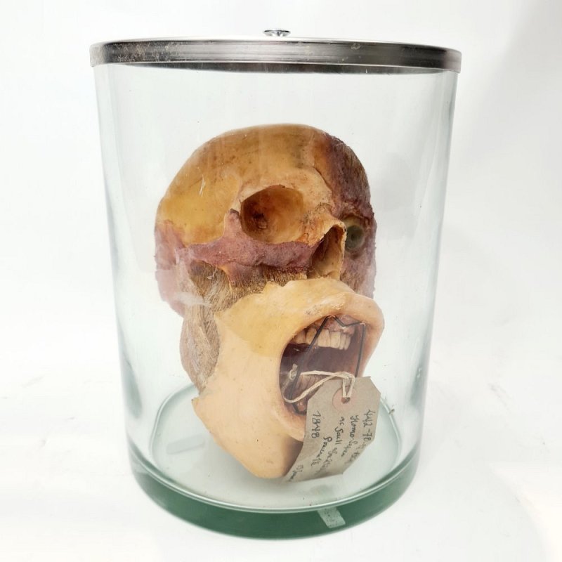 Deconstructed Human Head In Jar