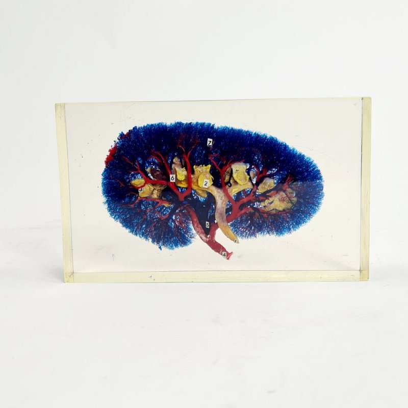 Kidney In Resin