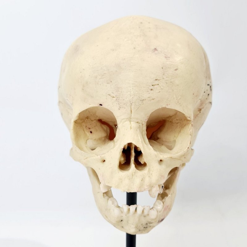 Baby Skull Model On Stand
