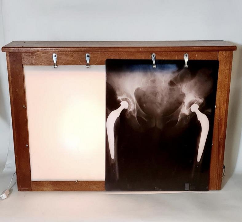 Period Wooden X-Ray Light Box