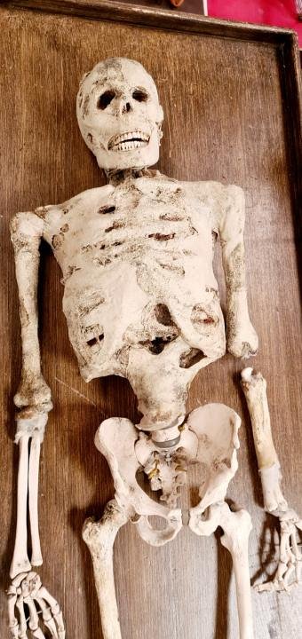 Composite Skeleton with Mumified Skin