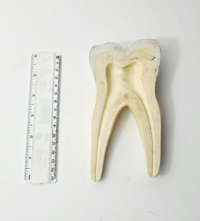 Tooth Model