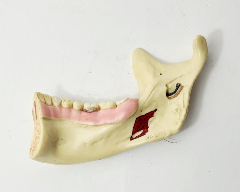 Jaw Model