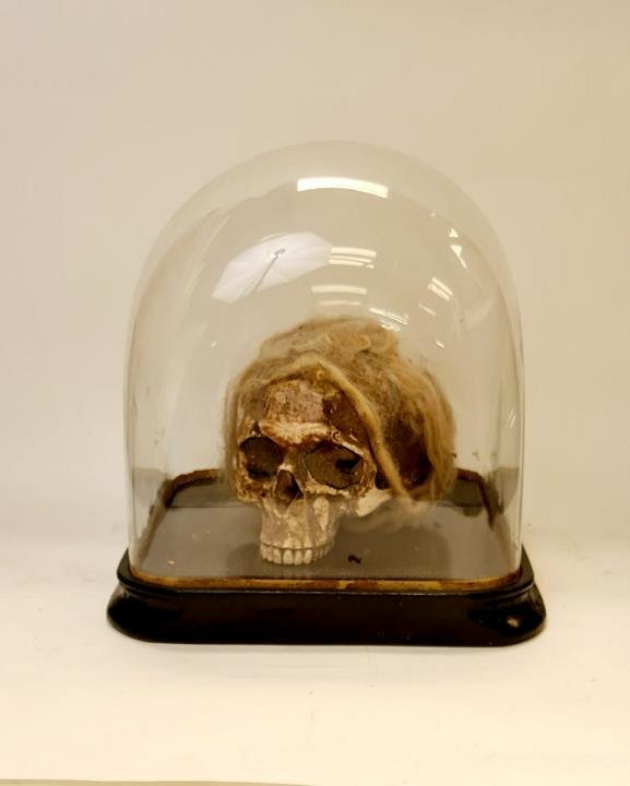 Composite Human Skull Under Glass Done