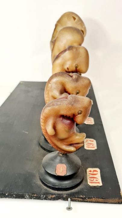 Wax Model Of Developing Foetus