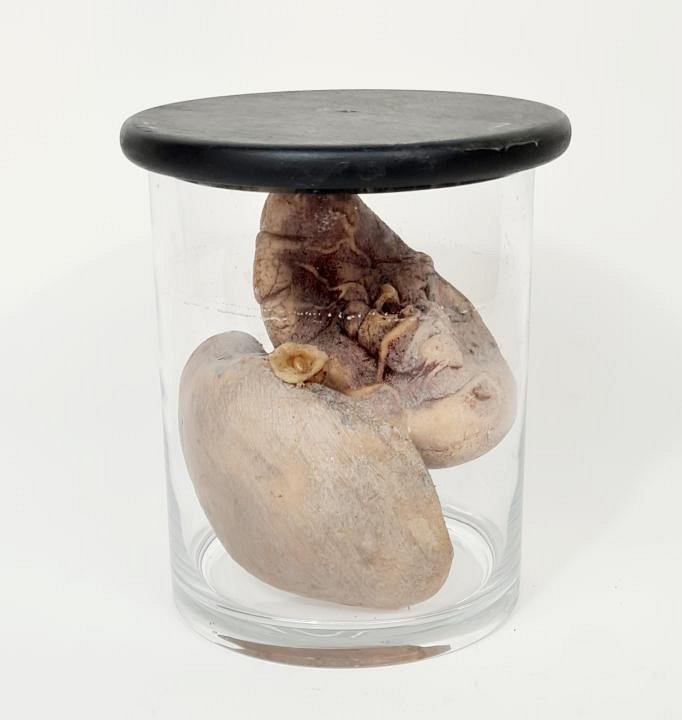 Imitation Human Kidnets In Glass Jar