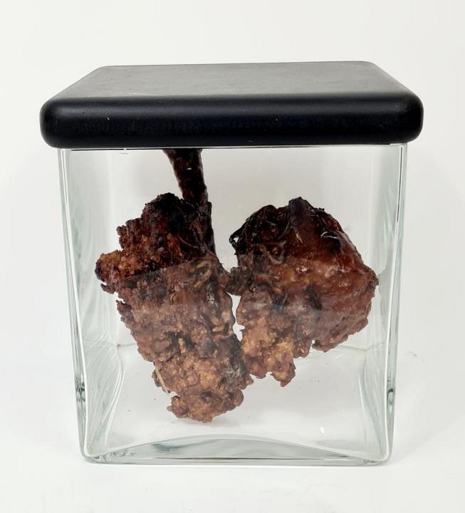 Imitation Human Lungs In Glass Jar