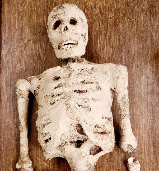 Composite Skeleton with Mumified Skin