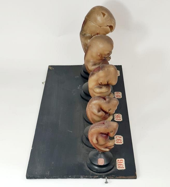 Wax Model Of Developing Foetus