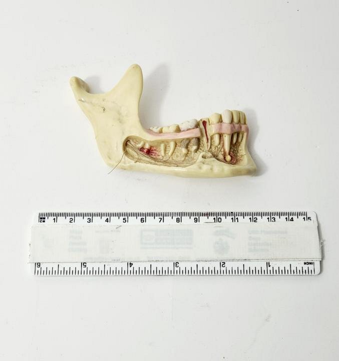 Jaw Model