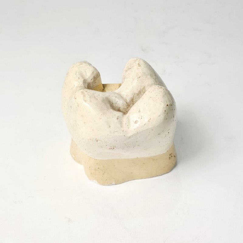 Ceramic Tooth Model