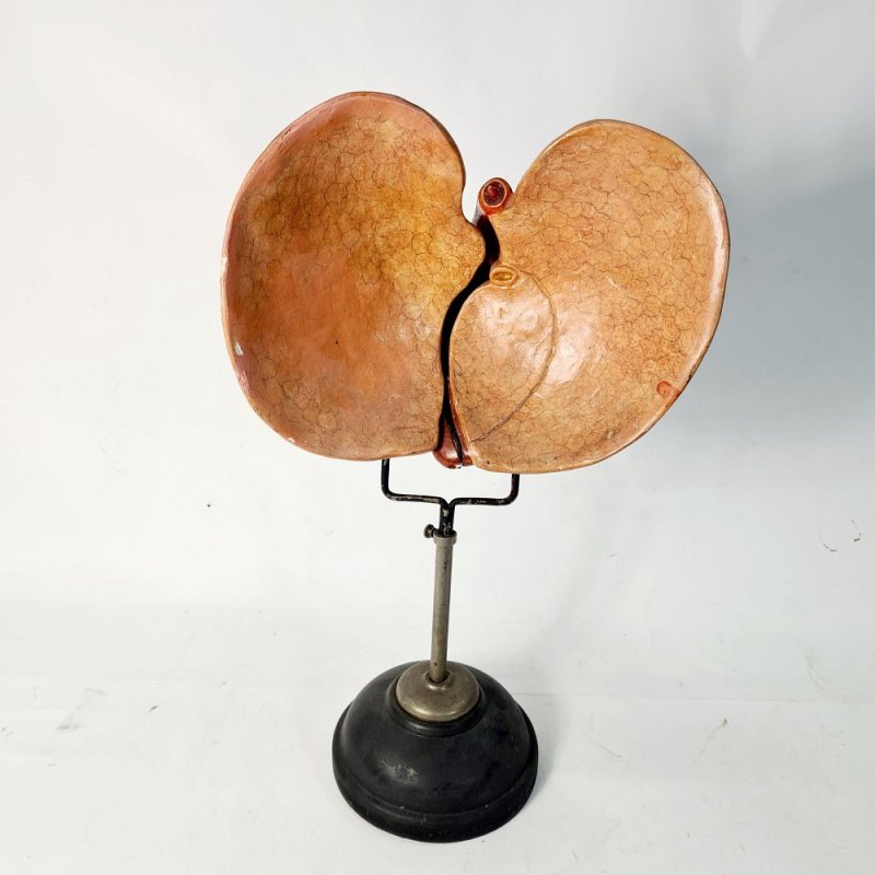 Anatomical Model Lung On Stand