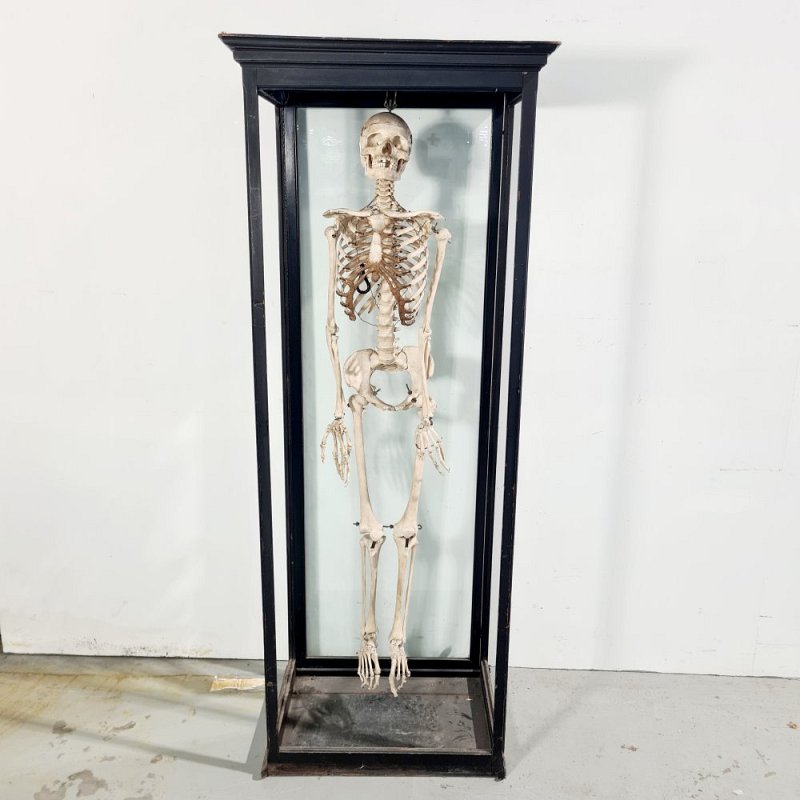 Vintage Human Teaching Skeleton in Glass Case