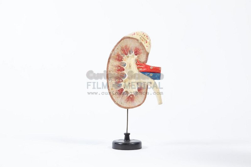 Lung Model