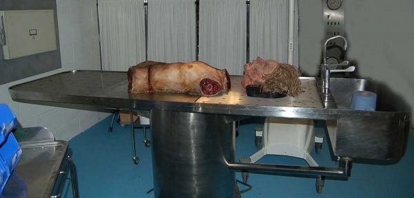 Torso and Severed Head in the Morgue