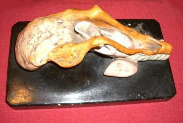 Plaster Model Of The Tongue