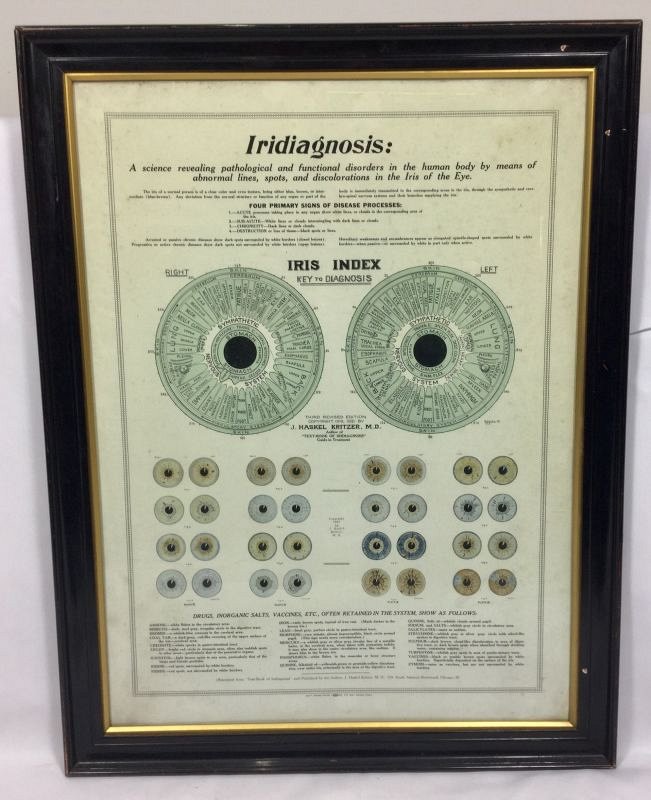 Eye conditions