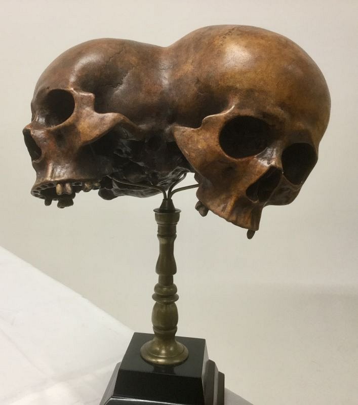 Conjoined skull