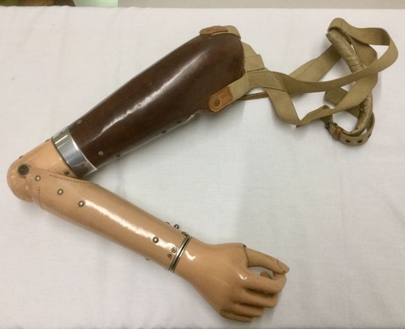 Prosthetic arm