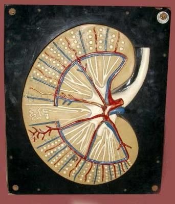 Model kidney wall plaque