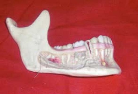 Model Jaw with Teeth