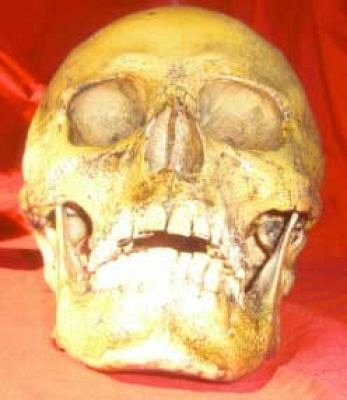 Human Skull