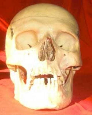 Human Skull