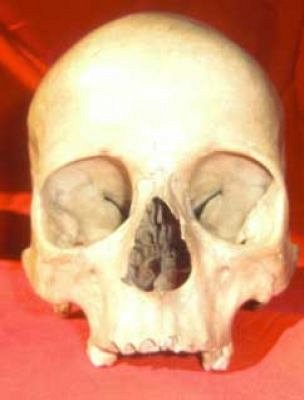 Human Skull