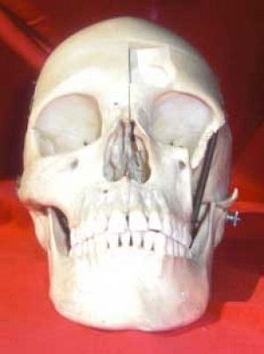 Human Skull