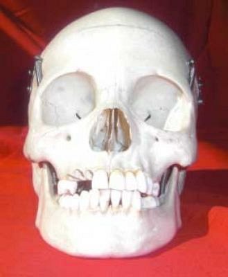 Human Skull