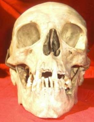 Human Skull