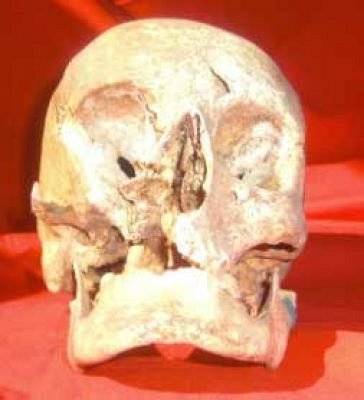 Human Skull