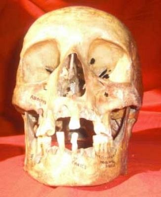 Human Skull