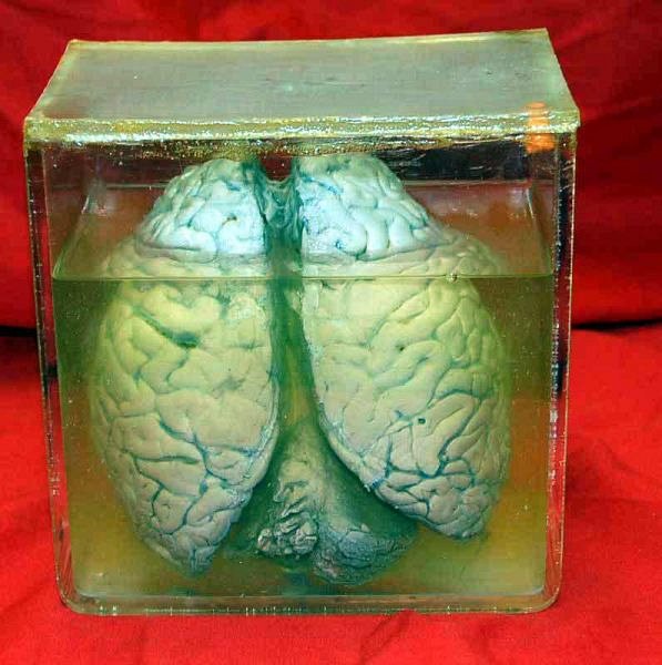 Preserved Brains In Glass Tank