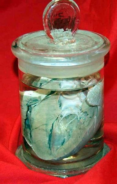 Specimen Preserved In Glass Jar